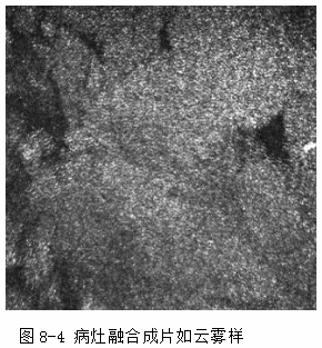 ZY016_34_4.gif